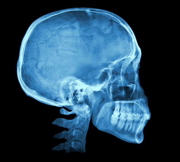 Image sourcé de https://www.freepik.com/premium-photo/human-skull-x-ray-image_6368117.htm d'un radiographie